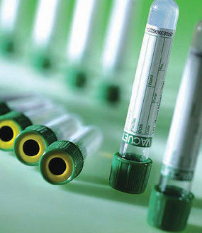 Green Top Sodium Heparin Blood Collection Tubes Heparin Lithium Sodium Tube